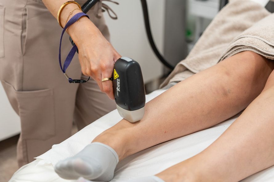 Laser hair removal treatment